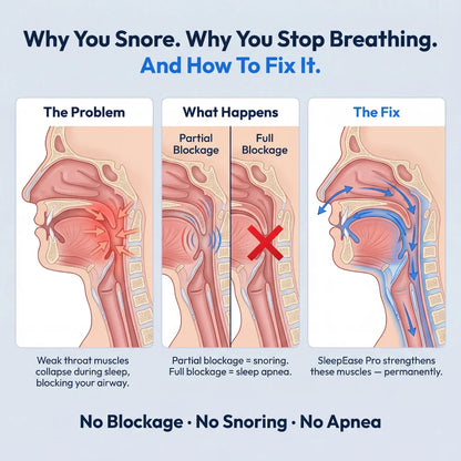Sleep Ease Pro: Eliminate Snoring & Sleep Apnea